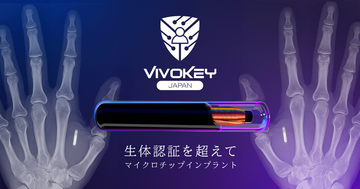 マイクロチップリーダー　デジタルエンジェル社製造 ニードル式ディスペンスシステム NEEDLE SPOTTER 350PC | 武蔵
